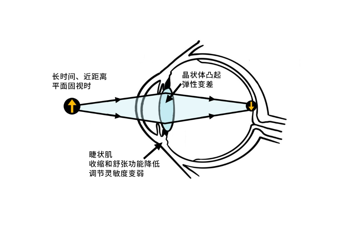 裸眼3D视觉训练，防控近视新科技